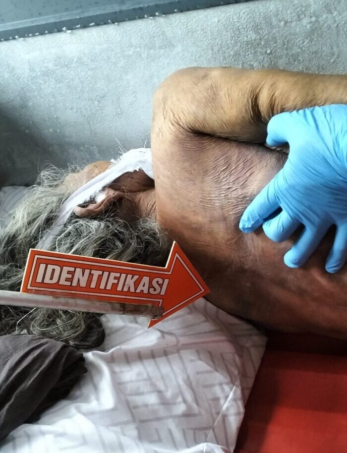 seorang-lansia-di-tianyar-barat-tewas-berikut-perhiasan-emas-korban-hilang